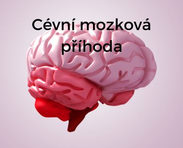 Blog - mozková mrtvice